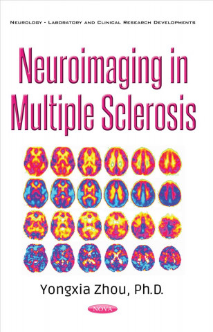 Neuroimaging in Multiple Sclerosis