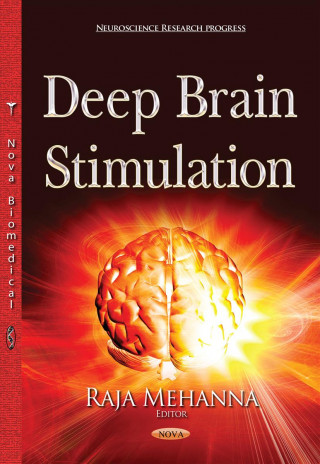 Deep Brain Stimulation