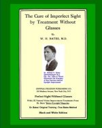 Cure Of Imperfect Sight by Treatment Without Glasses