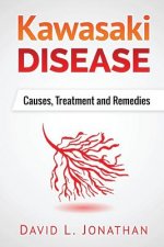 Kawasaki disease - A Slowly Developed Health Issue: Causes, Treatment and Remedies