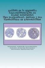 Análisis de la expresión inmunohistoquímica en cáncer colorrectal: Tipo convencional, serrado y con inestabilidad de microsatélites