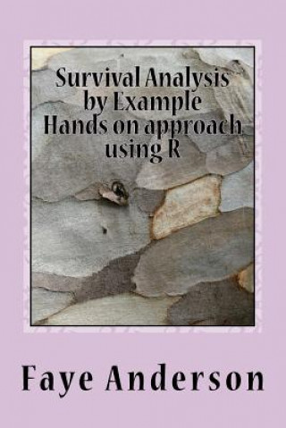 Survival Analysis by Example: Hands on approach using R