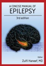 A concise manual of epilepsy: 3rd edition