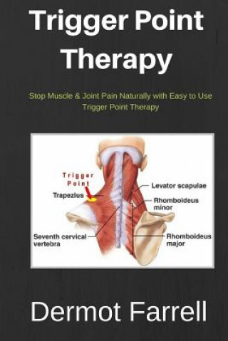 Trigger Point Therapy: Stop Muscle & Joint Pain Naturally with Easy to use Trigger Point Therapy (MR Dermot Farrell)(Puha kötésű)