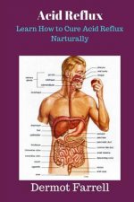 Acid Reflux: Learn How to Cure Acid Reflux Naturally