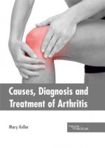 Causes, Diagnosis and Treatment of Arthritis