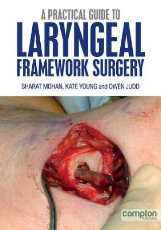 Practical Guide to Laryngeal Framework Surgery