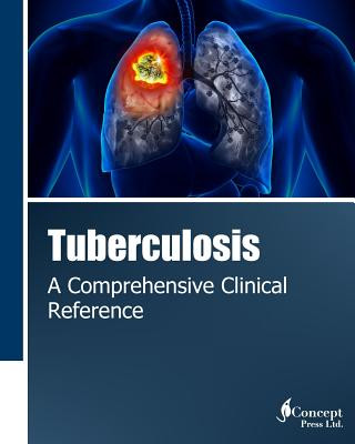 Tuberculosis: A Comprehensive Clinical Reference