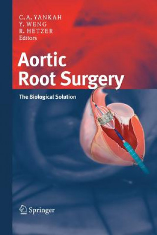 Aortic Root Surgery