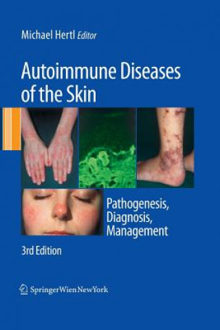 Autoimmune Diseases of the Skin