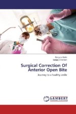 Surgical Correction Of Anterior Open Bite