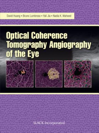Optical Coherence Tomography Angiography of the Eye