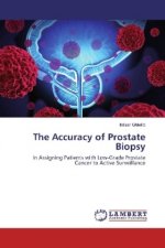 The Accuracy of Prostate Biopsy