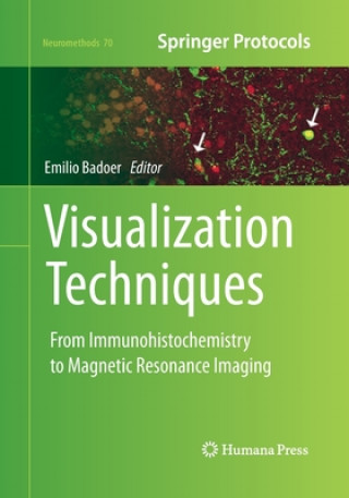 Visualization Techniques