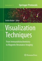 Visualization Techniques