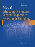 Atlas of Intraoperative Frozen Section Diagnosis in Gynecologic Pathology