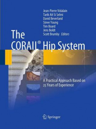 CORAIL (R) Hip System