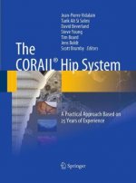 CORAIL (R) Hip System