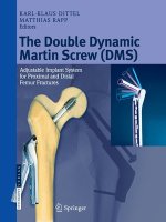 Double Dynamic Martin Screw (DMS)