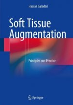 Soft Tissue Augmentation