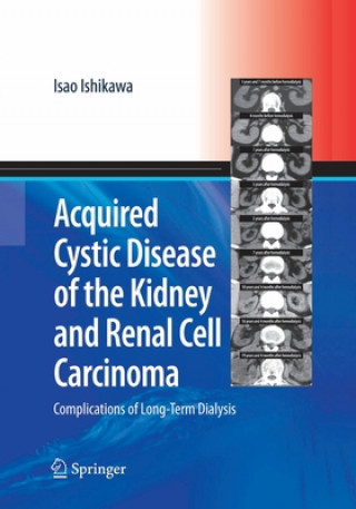 Acquired Cystic Disease of the Kidney and Renal Cell Carcinoma