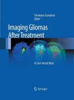 Imaging Gliomas After Treatment