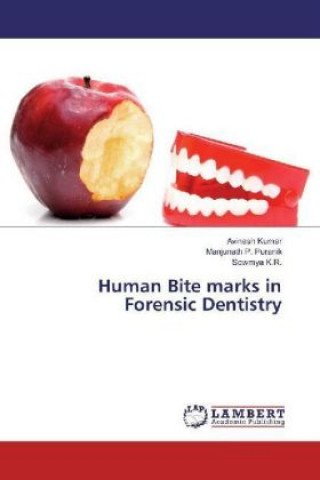 Human Bite marks in Forensic Dentistry