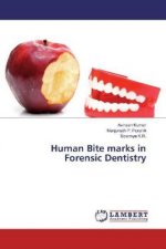 Human Bite marks in Forensic Dentistry