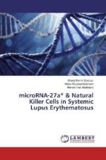 microRNA-27a & Natural Killer Cells in Systemic Lupus Erythematosus