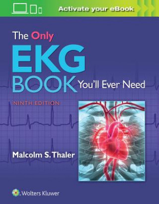 Only EKG Book You'll Ever Need