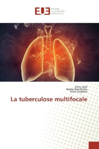 La tuberculose multifocale