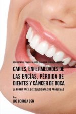 86 Recetas de Comidas y Jugos Para Ayudarle A Prevenir Caries, Enfermedades de Las Encias, Perdida de Dientes y Cancer de Boca