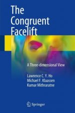 Congruent Facelift