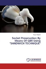 Socket Preservation By Means Of GBR Using 