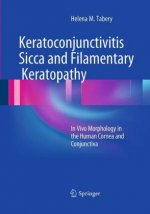 Keratoconjunctivitis Sicca and Filamentary Keratopathy