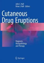 Cutaneous Drug Eruptions