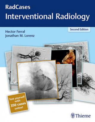 RadCases Q&A Interventional Radiology