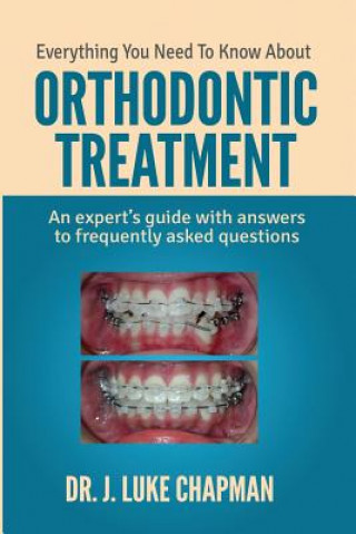 Everything You Need To Know About Orthodontic Treatment: An expert's guide with answers to frequently asked questions
