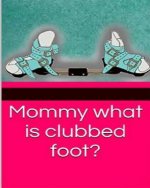 Mommy what is clubbed foot?