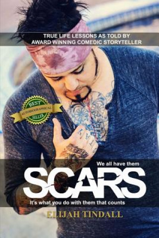 Scars: We all have them, it's what we do with them that counts