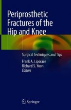 Periprosthetic Fractures of the Hip and Knee