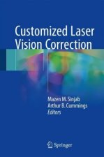 Customized Laser Vision Correction
