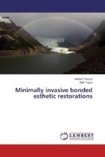 Minimally invasive bonded esthetic restorations