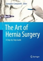 Art of Hernia Surgery