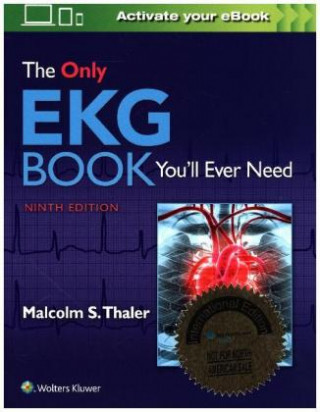 Only EKG Book You'll Ever Need