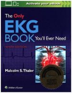 Only EKG Book You'll Ever Need