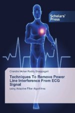 Techniques To Remove Power Line Interference From ECG Signal