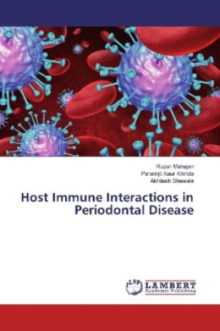 Host Immune Interactions in Periodontal Disease