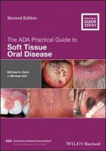 ADA Practical Guide to Soft Tissue Oral Disease 2e