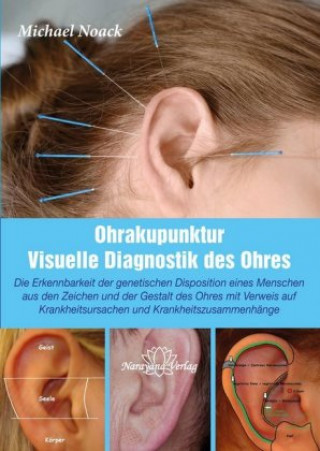 Visuelle Ohrdiagnostik als Grundlage der Ohrakupunktur